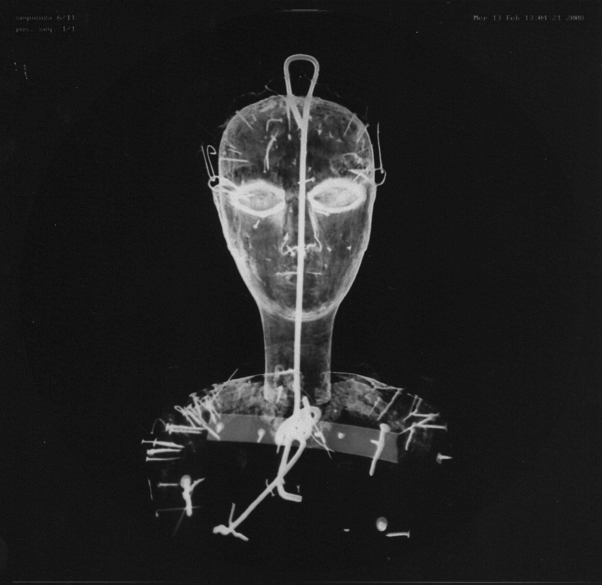 Radiografia della testa